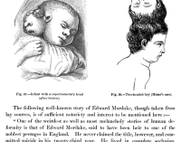 Edward Mordrake, Anomalies and Curiosities of Medicine, 1901